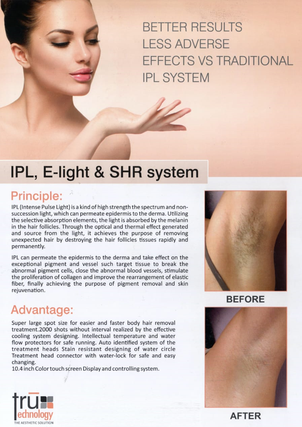 E-Light+IPL